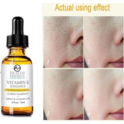 Minch Organic Vitamin E Face Serum Reduce Wrinkles Moisturizing Essence Skin Care Anti-Wrinkle Tight Whitening Skin Serum