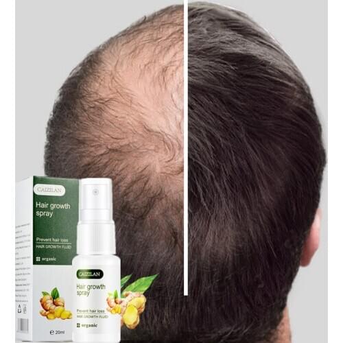 20ml Hot sale Ginger Fast Hair Growth Essence Oil Hair Loss Treatment Help for hair Growth Hair Care