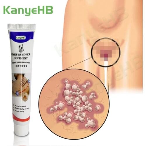 2pcs Wart Remover Ointment Vulva Condyloma Genital Herpes Genital Acuminatum Skin Tag Remover Antibacterial Treatment Cream A634