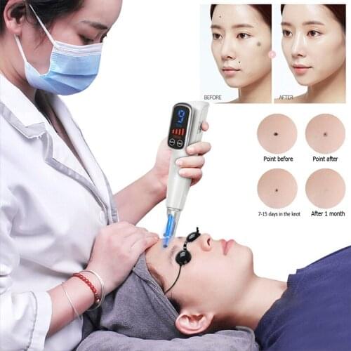 Professional Laser Picosecond Pen Freckle Tattoo Removal Mole Dark Spot Pigment Touch Screen Handheld Laser Acne Treatment Tool