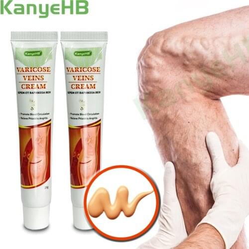 2pcs Varicose Veins Ointmnet Treatment Varicosity Herbal Medical Plaster Vasculitis Phlebitis Angiitis Phlebitis Ointment A640