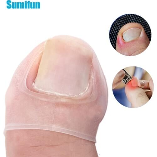 2pcs Silicone Paronychia Invisible Nail Acronyx Orthotics Patch Ingrown Toe Nail Correction Patch Foot Care Treatment Pedicura