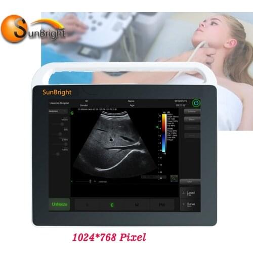 Ultrasound probe fetal monitor hospital clinic use pregnancy test laptop ultrasound