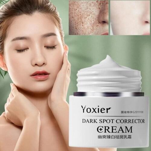 30g Face Cream Dark Spot Corrector Anti-Aging Whitening Moisturizing Remove Sunburn Dark Spots and Acne Pigmentation