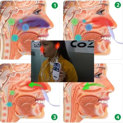 Nose Rhinitis Sinusitis Cure Therapy Massager Nasal Medical Machine Hay Fever Low Frequency Pulse Laser Nose Health Care Machine