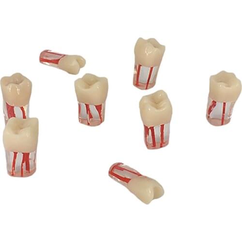 Dentistry Exam Open Pulp Canal Model in Vitro Pulp Cavity 0.4×0.4×1.6 inches