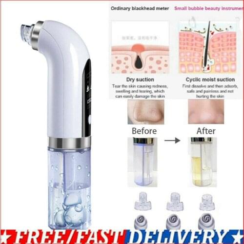 Electric Small Bubble Blackhead Remover USB Rechargeable Water Cycle Pore Acne Pimple Removal Vacuum Suction Facial Cleaner Tool