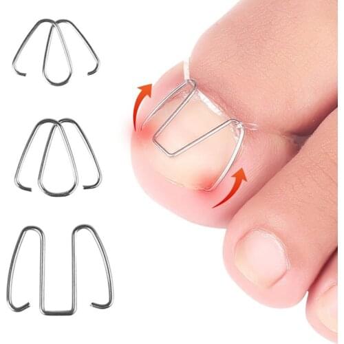 3Pairs Front nail hook/rubber band Nail Art Ingrown Toe Nail Correction Toenail Nail Ingrown Clip Orthosis Paronychia Pedicure
