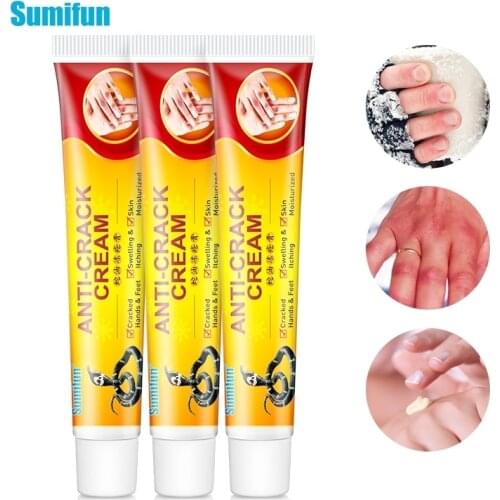 3pcs Anti-cracking Cream Frozen Frostbite Ointment Anti pruritic Rough Dry Cracked Chapped Cream Herbal Plaster Frostbite Oil