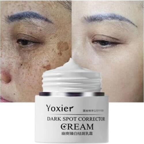 30g Face Cream Dark Spot Corrector Anti-Aging Whitening Moisturizing Remove Sunburn Dark Spots and Acne Pigmentation