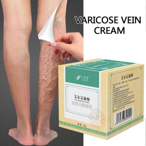 Varicose Veins Treatment Cream Relief Veins Pain Phlebitis Legs Varicose Veins Body Cream Chinese Natural Herbal Body Cream