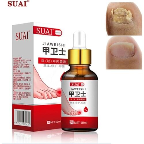 SUAI Fungal Nail Repair Essence Serum Care Treatment Foot Nail Fungus Removal Gel Anti Infection Paronychia Onychomycosis