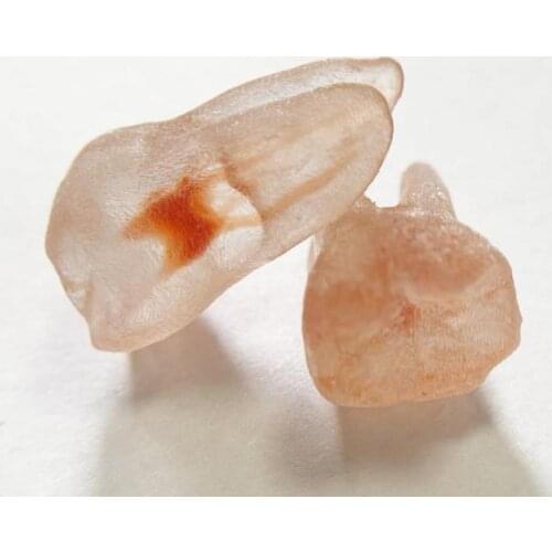 Lower Molar A Dental Blocks Endo Files Practise Student 3D Simulation Tooth Replicas Teeth Pulp Model Red Root Canal 2-1-2