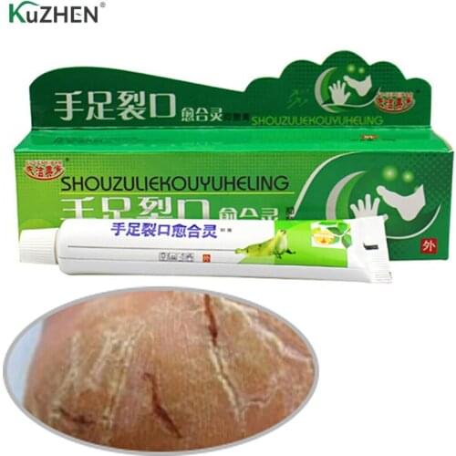 Powerful Hand Foot Crack Cream Heel Chapped Peeling Foot And Hand Repair Anti Dry Crack Skin Care Chinese Ointment