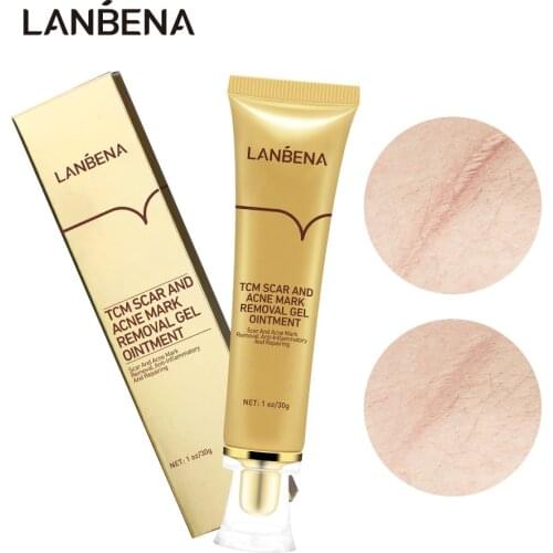 LANBENA Acne Scar Removal Cream Cosmetics For Face Screm TCM Herbal Repair Stretch Marks Remove Scar Treatment Bioaqua Skin Care