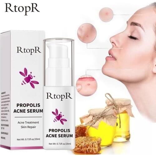 Propolis Repair Acne Serum Skin Brightening Care Acne Scar Spots Cleaning Serum Shrink Pores Eliminates Oil control Treatment
