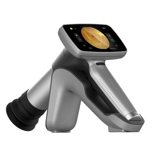 Handheld Fundus Camera Ophthalmoscope HD Ophthalmic Instrument With High Resolution