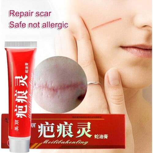 Natural Messager Acne Scar Repair Cream Moisturizing Whitening Remover Bacteriostatic Face Skin Care Treatment Dropshipping