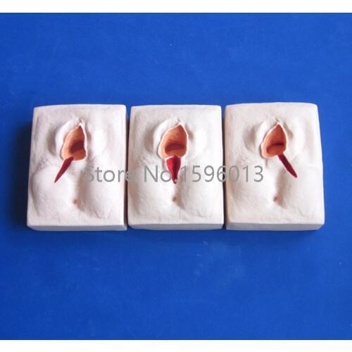 Vulva Suturing Training Simulator 3-set, Perineum Suturing Training Model,Episiorrhaphy trainer model