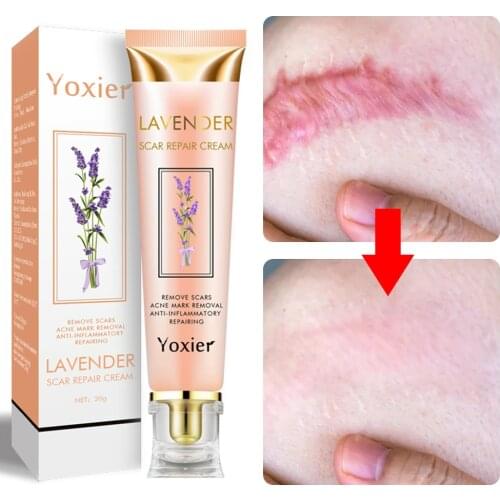 Lavender Scar Repair Cream Repairing Removing Burn Scars Promote Cell Regeneration Enhance Elasticity Cucumber Skin Care 20g