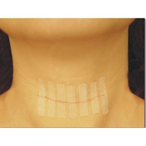 10pcs 12mm*100mm Non seam adhesive tape skin closure of wound strips wounds steri types medical surgical nonwoven suture tape