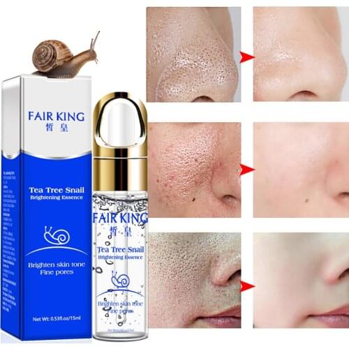 FAIR KING Snail Serum Facial Essence Hyaluronic Acido Hialuronico Whitening For Face Skin Care Face Shrink Pores Anti Aging