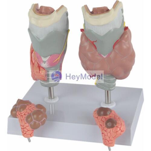 HeyModel Thyroid pathology model endocrine thyroid disease display model