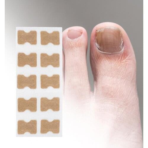 1Pcs/5Pcs/10Pcs Toenails Sticker Breathable Convenient Non Woven Fabric Paronychia Treatment Decal for Household