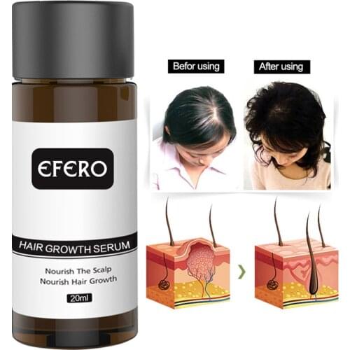 Hair Growth Essence Hair Loss Dense Hair Rapid Growth Oil Restoration Growth Serum