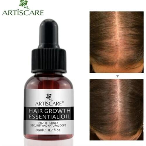 7days Ginger Hair Loss Oil for Fast Hair Growth Keratin Tratamiento Para El Cabello Hair Growth Serum Oil Products Soin Cheveux