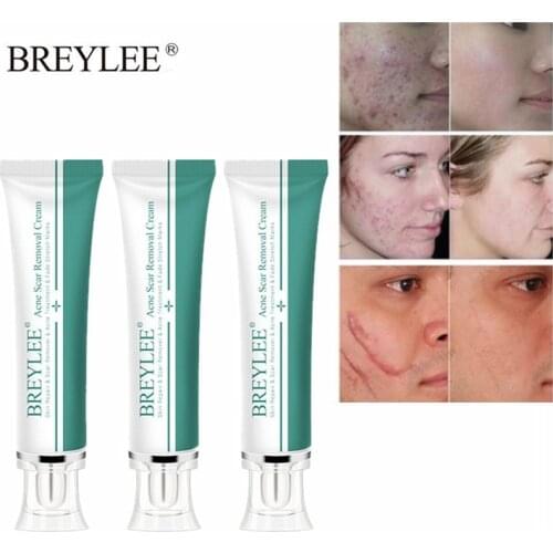 BREYLEE 3PCS Acne Scar Removal Cream Face Cream Skin Repair Skin Care Scar Acne Treatment Remove Stretch Marks Whitening Cream