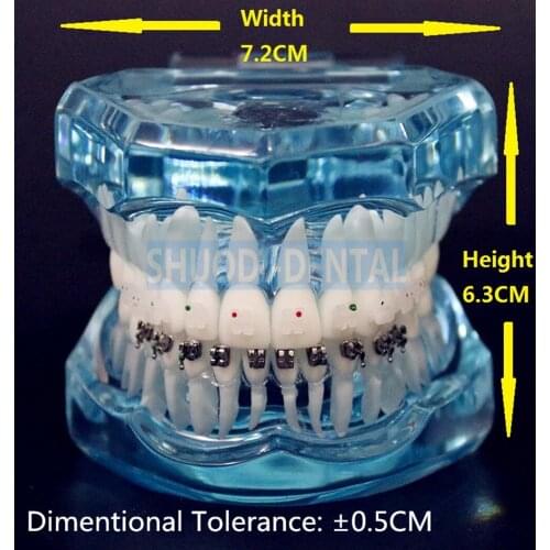 1 piece Dental Orthodontic Teeth Model with Ceramic and Metal Brackets for Patient Communication Transparent