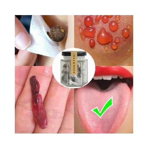Acupuncture Massage 30/60/pcs Moxibustion Massage Paste Navel Stickers Moxibustion Thenar Moxa Sticker free shipping