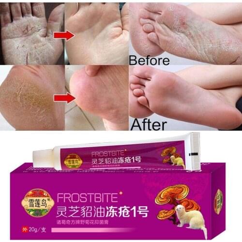 Area Ice Frostbite Cream Moisturizing Moisturizing Anti-freezing Ointment Repair Whol Dry Anti-cracking Anti-cracking Z1J3