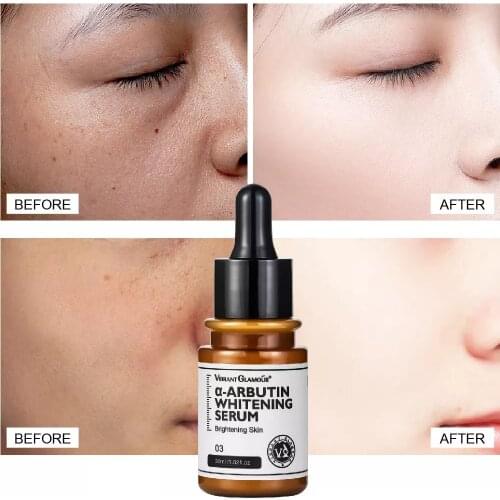 VIBRANT GLAMOUR Arbutin Whitening Face Serum Fade Spot Acne Marks Brighting Essence Smooths Pores Moisturizing Facial Skin Care
