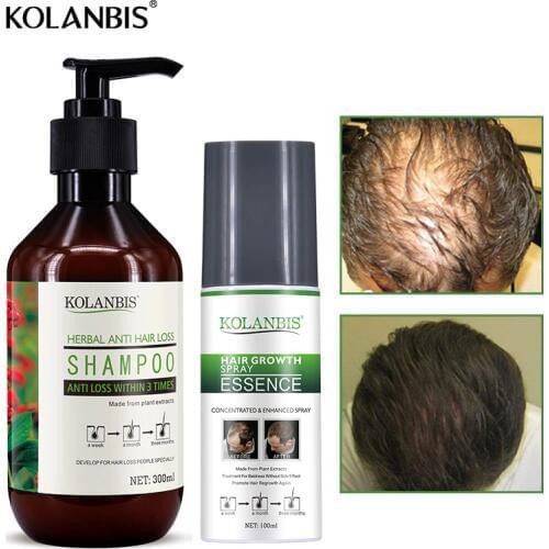 KOLANBIS Anti Hair Loss Shampoos
