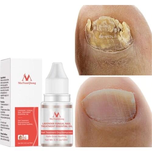 Наборы для маникюра Aichun Beauty China At AliExpress