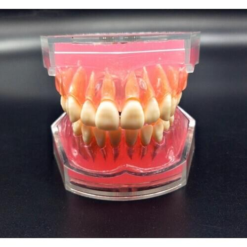 Dental Study Teaching Model Standard Model Removable Teeth Soft Gum ADULT TYPODONT Model