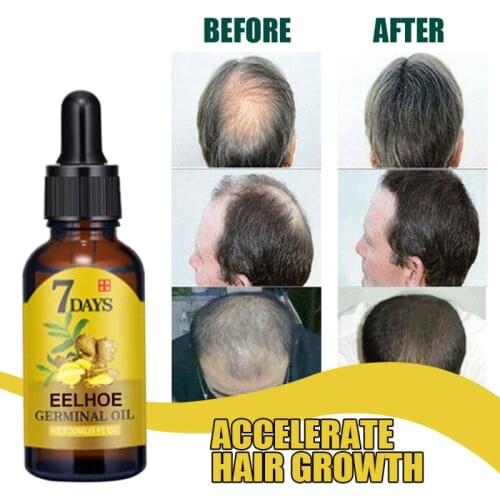 10/15/20/40ml 7 Days Fast Hair Growth Liquid Effective Natural Ginger Plant Hair Loss Repair Damaged Hair Growing Liquid