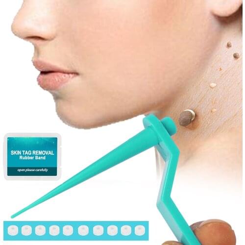 Micro skin tag remover Rubber bands for micro Skin tag remover wart Remove Acne remover Treatments Face Skin Care Beauty Tools