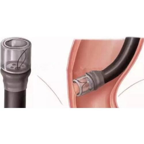 Olympus Transparent cap Transparent mucosal suction sleeve reusable Endoscope consumables