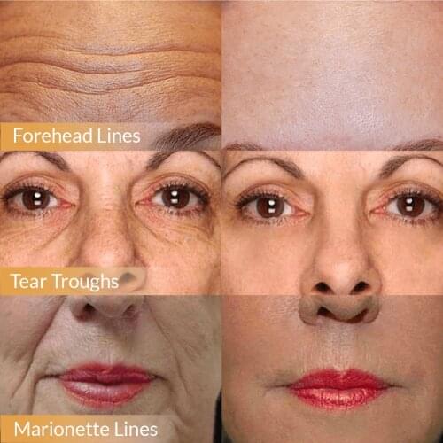 Line Rewind 24K Gold Serum Anti-Aging Face Cream Wrinkle Skin Lift Six Peptides Serum