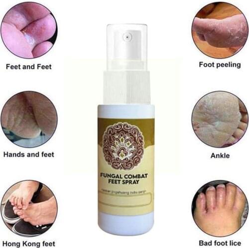 Herbal Effective Foot Treatment Anti Fungal Infection Foot Repair Toe Care Fungus Onychomycosis Treatment Paronychia Feet C E3U2