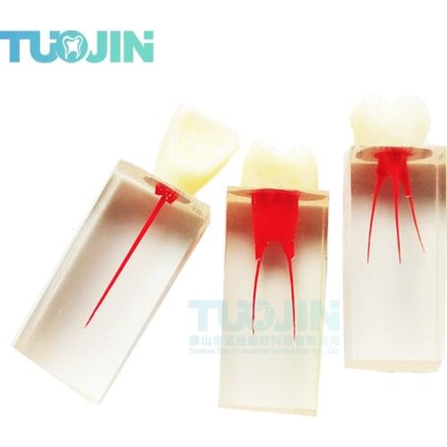 2PCS Dental Endodontic Tooth Model Root Canal Block Teeth Orthodontics Tooth For Students Practice Model Training Teeth Model