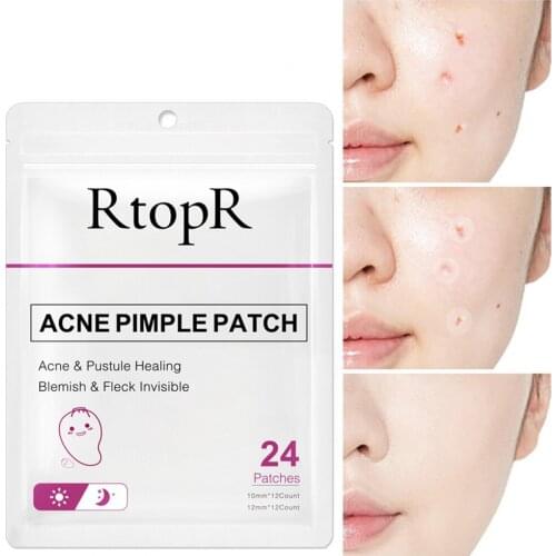 24PCS Acne Remover Treatment Cream Blackhead Remover Mask Acne Remover Tool Black Pimple Scar Skin Tag Removal Acne Patch