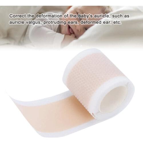 4 x100cm/Roll Silicone Kids Infant Protruding Ear Patch Sticker Newborn Baby Ear Aesthetic Corrector Ear Auricle Correction Tape