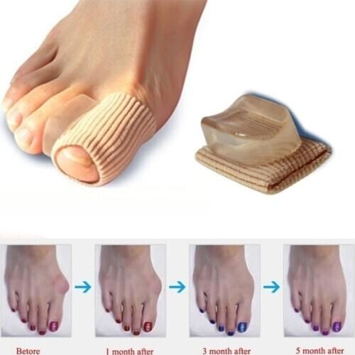 1Pc Feet Care Special Hallux Valgus Thumb Orthopedic Deliver Braces Correct Daily Silicone Against Big Bot Foot Care Tool
