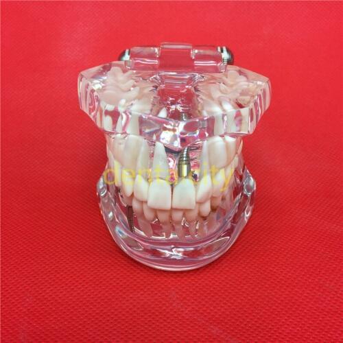 Dental Teeth Models Are Used For Teaching And Hospital Dentist Material