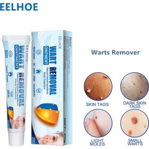 EELHOE 20g Warts Remover Ointment Acne Wart Treatments Cream Skin Tag Remover Herbal Extract Corn Plaster Skin Care Body Creams