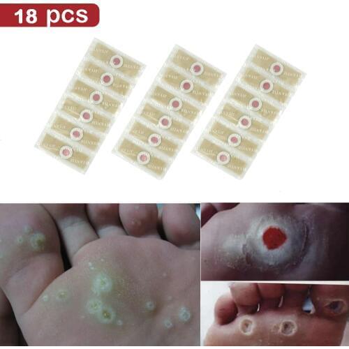 18pcs Medical Plaster Foot Corn Removal Remover Warts Thorn Patch For Foot Calluses atches Corn of feet Calluses Callosit z08053